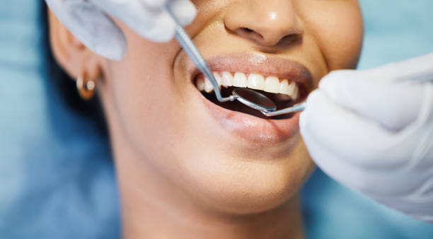 Best Emergency Dental Care for Abscessed Tooth in Trinity, TX