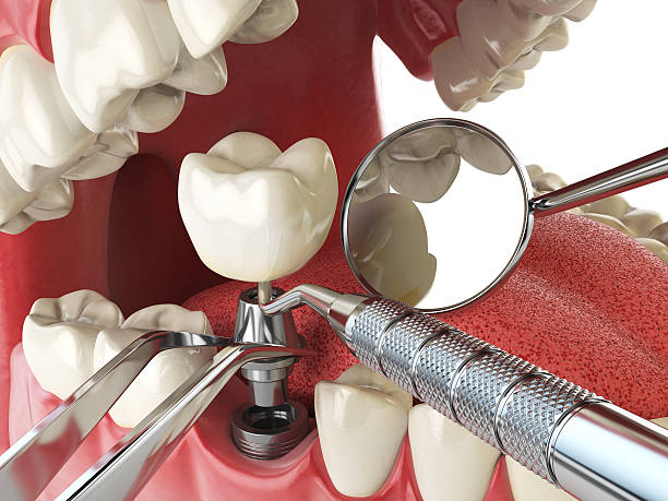 Best Weekend Emergency Dentist in Trinity, TX