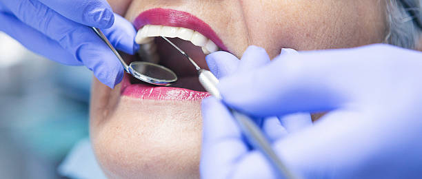 Best Emergency Dental Services for Seniors in Trinity, TX